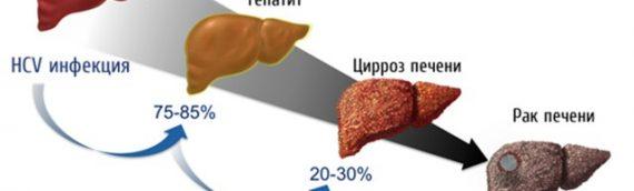 Российские исследователи научили гелиомицин лечить рак печени