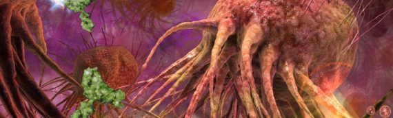 Биологи выяснили, как раковые клетки начинают «гулять» по организму